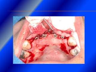 Clase Conexiones 2008 Alumn