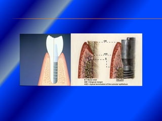 Clase Conexiones 2008 Alumn