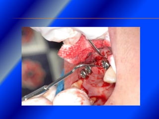 Clase Conexiones 2008 Alumn