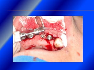 Clase Conexiones 2008 Alumn