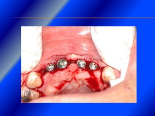 Clase Conexiones 2008 Alumn