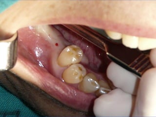 Clase Conexiones 2008 Alumn