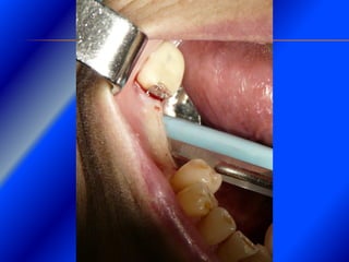 Clase Conexiones 2008 Alumn