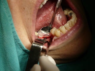 Clase Conexiones 2008 Alumn