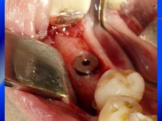 Clase Conexiones 2008 Alumn