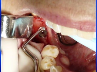 Clase Conexiones 2008 Alumn