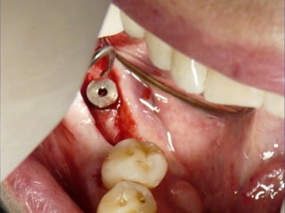 Clase Conexiones 2008 Alumn