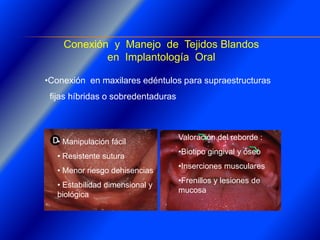 Clase Conexiones 2008 Alumn