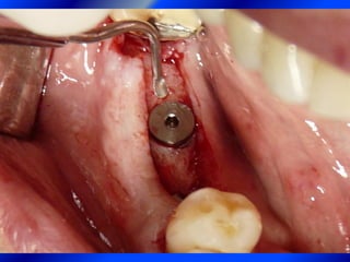 Clase Conexiones 2008 Alumn