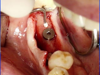 Clase Conexiones 2008 Alumn