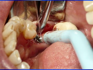 Clase Conexiones 2008 Alumn