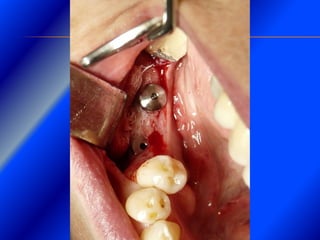 Clase Conexiones 2008 Alumn