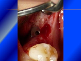 Clase Conexiones 2008 Alumn