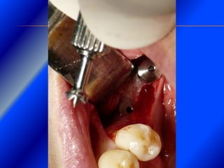 Clase Conexiones 2008 Alumn