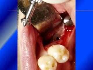 Clase Conexiones 2008 Alumn