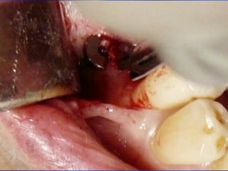 Clase Conexiones 2008 Alumn