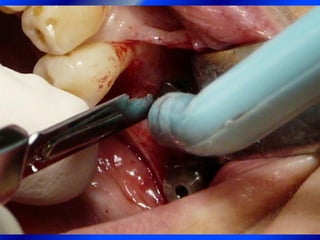 Clase Conexiones 2008 Alumn