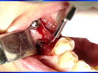 Clase Conexiones 2008 Alumn