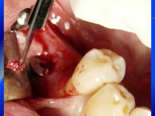 Clase Conexiones 2008 Alumn