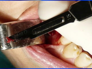 Clase Conexiones 2008 Alumn