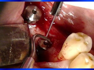 Clase Conexiones 2008 Alumn