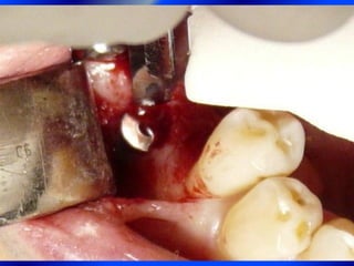 Clase Conexiones 2008 Alumn