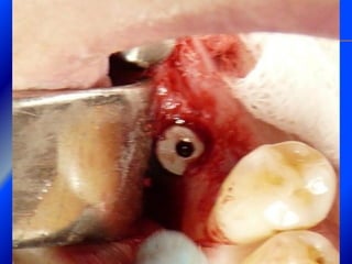 Clase Conexiones 2008 Alumn