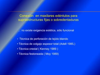 Clase Conexiones 2008 Alumn