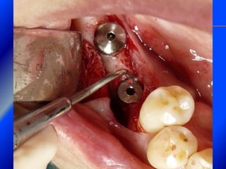 Clase Conexiones 2008 Alumn