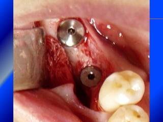 Clase Conexiones 2008 Alumn