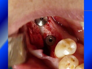 Clase Conexiones 2008 Alumn