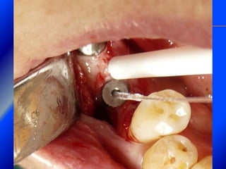 Clase Conexiones 2008 Alumn