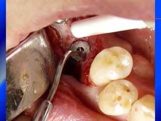 Clase Conexiones 2008 Alumn