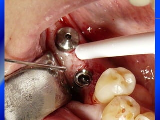 Clase Conexiones 2008 Alumn