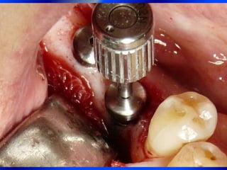 Clase Conexiones 2008 Alumn