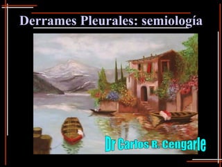Derrames Pleurales: semiología Dr Carlos R. Cengarle 