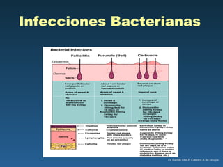Infecciones Bacterianas   