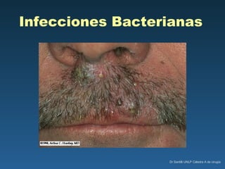 Infecciones Bacterianas   
