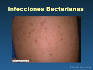 Infecciones Bacterianas   