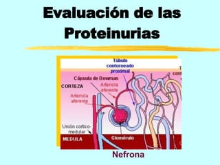 Evaluación de las Proteinurias Nefrona 