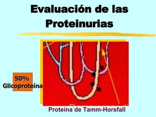 Evaluación de las Proteinurias Proteína de Tamm-Horsfall 50%  Glicoproteína 