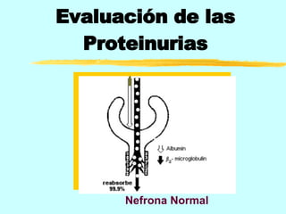 Evaluación de las Proteinurias Nefrona Normal 