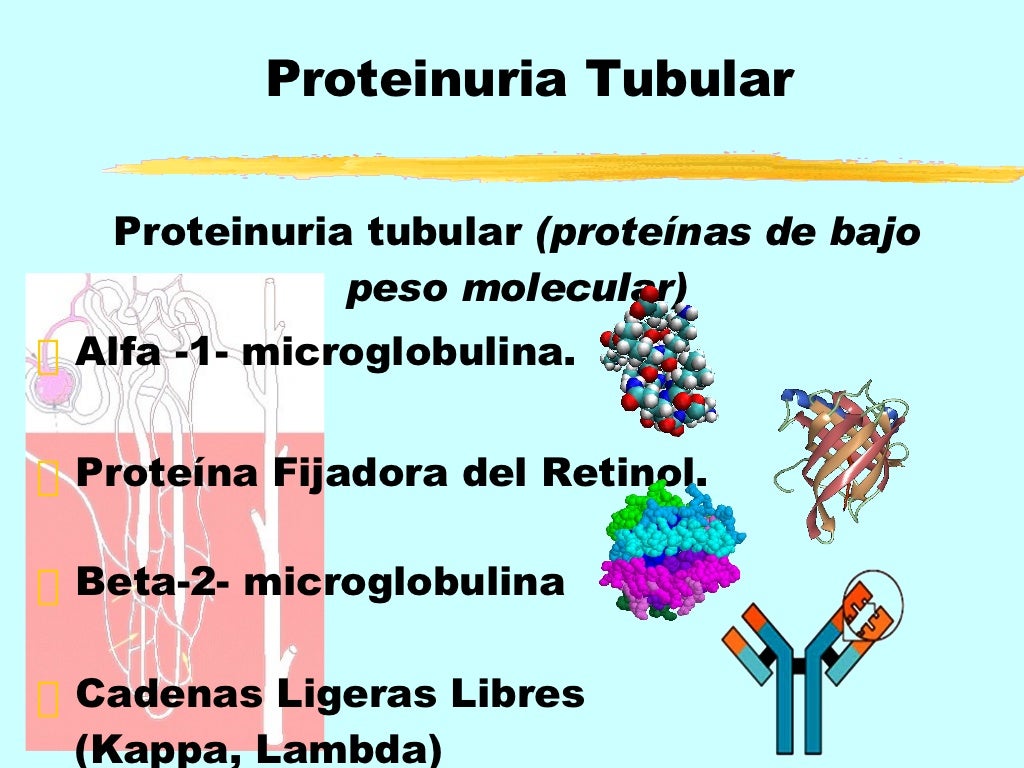 Proteinuria y sus causas