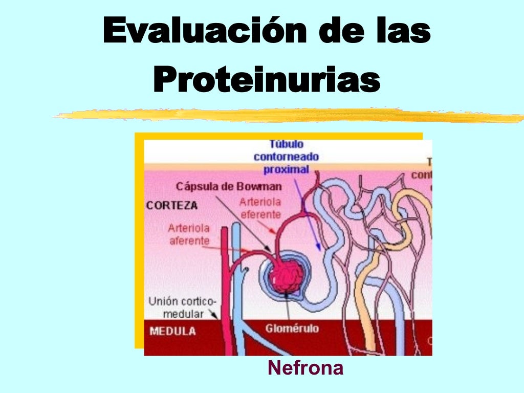Proteinuria y sus causas