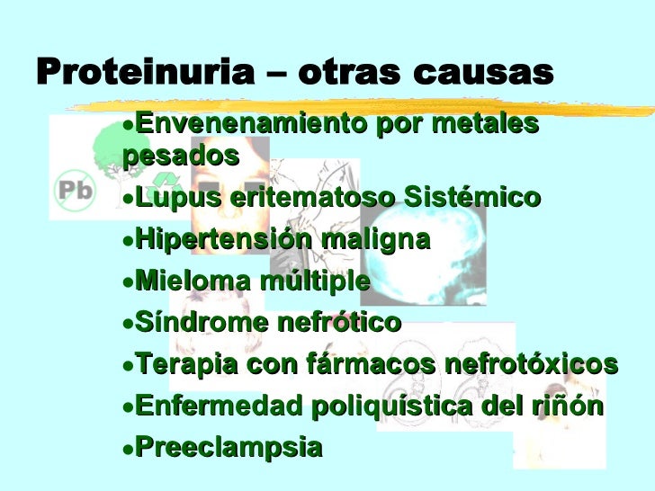 Proteinuria y sus causas