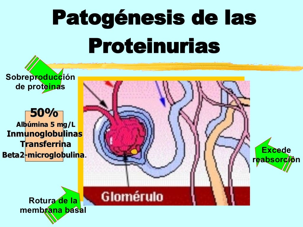 Proteinuria y sus causas