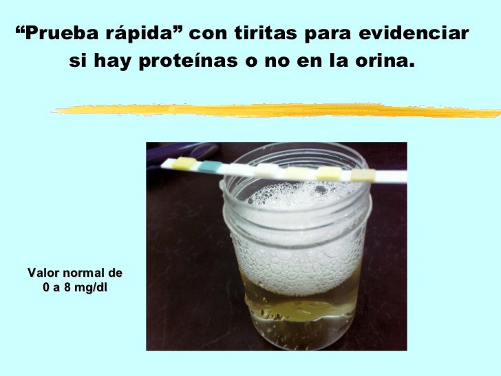 Proteinuria y sus causas