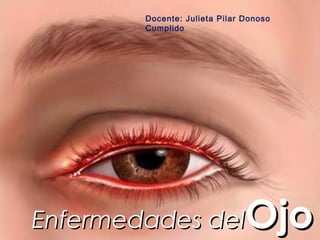Docente: Julieta Pilar Donoso
        Cumplido




Enfermedades del               Ojo
 