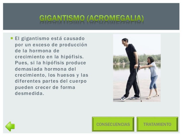 El adelgazamiento con la ayuda el clip en rostove-en-donu