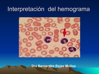 Interpretación del hemograma




        Dra Bernardita Rojas Muñoz
 